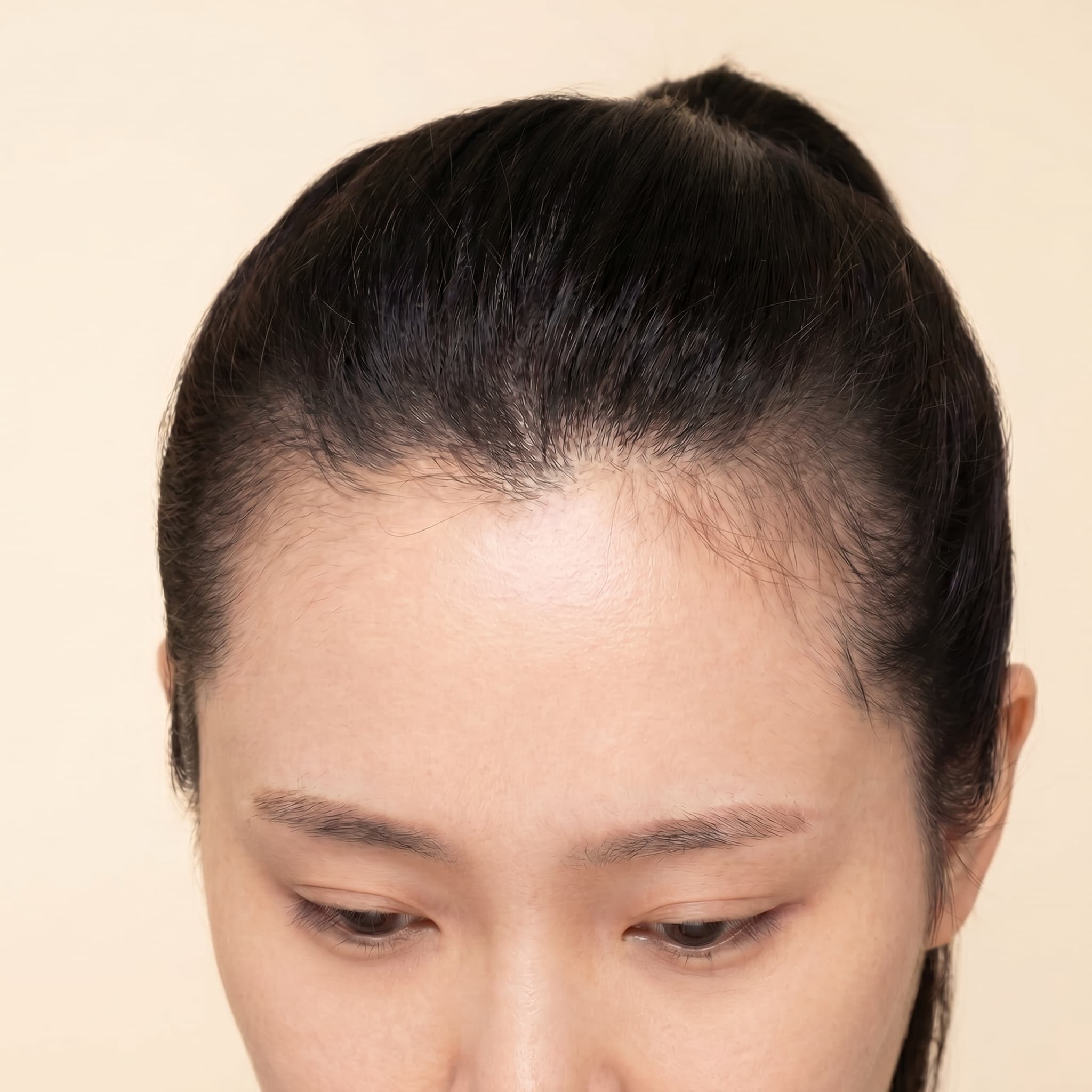 Soothed Scalp Irritation