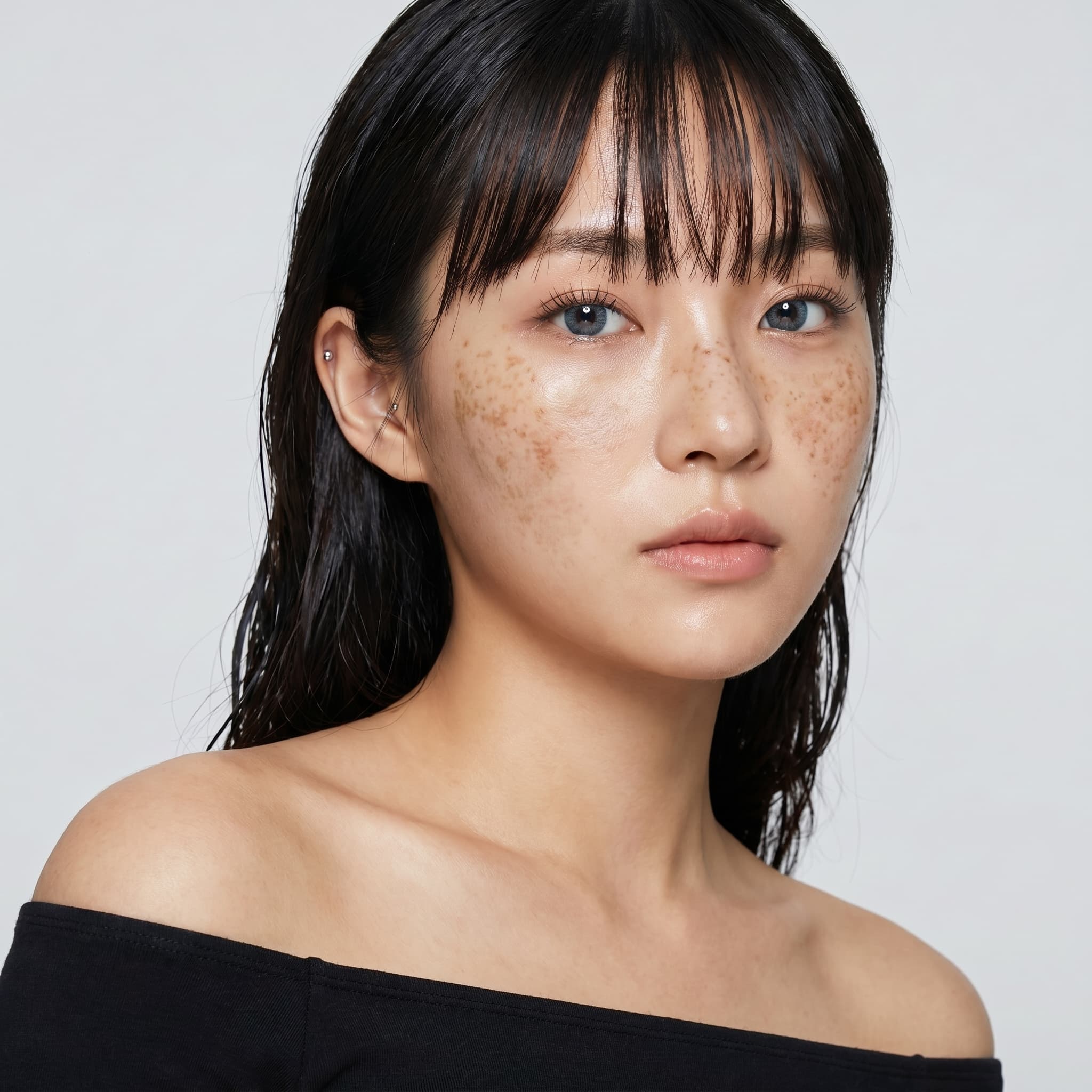 기미·색소침착