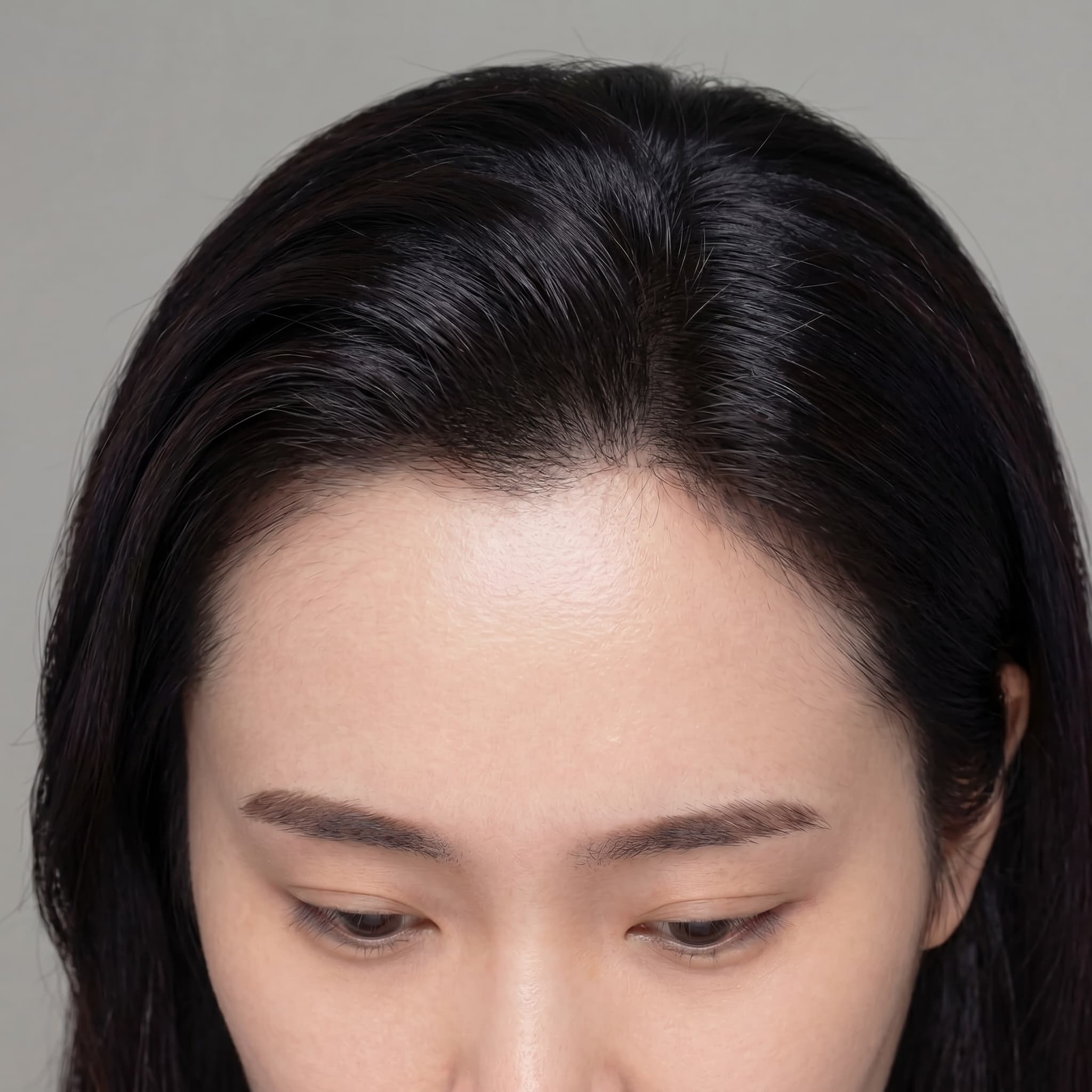 Customized Hair Removal