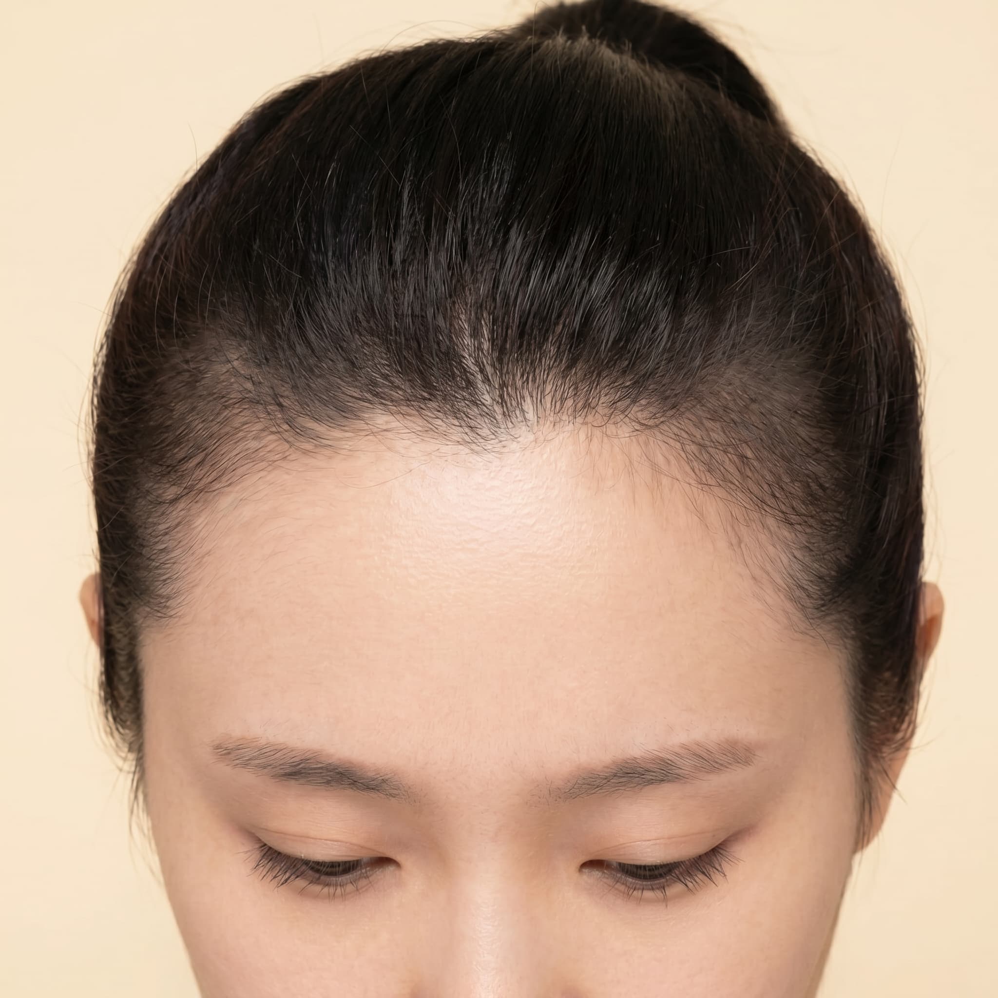 Clear Scalp Tone