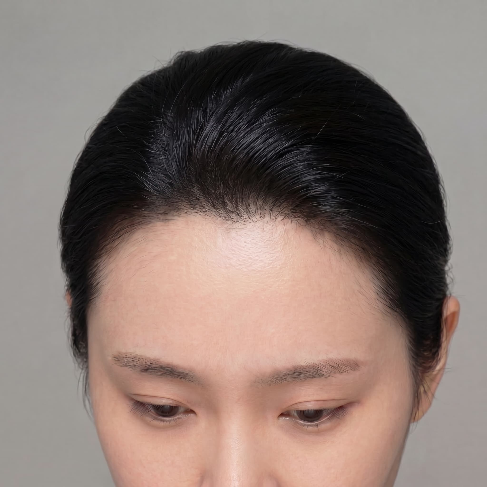抜け毛速度の減少