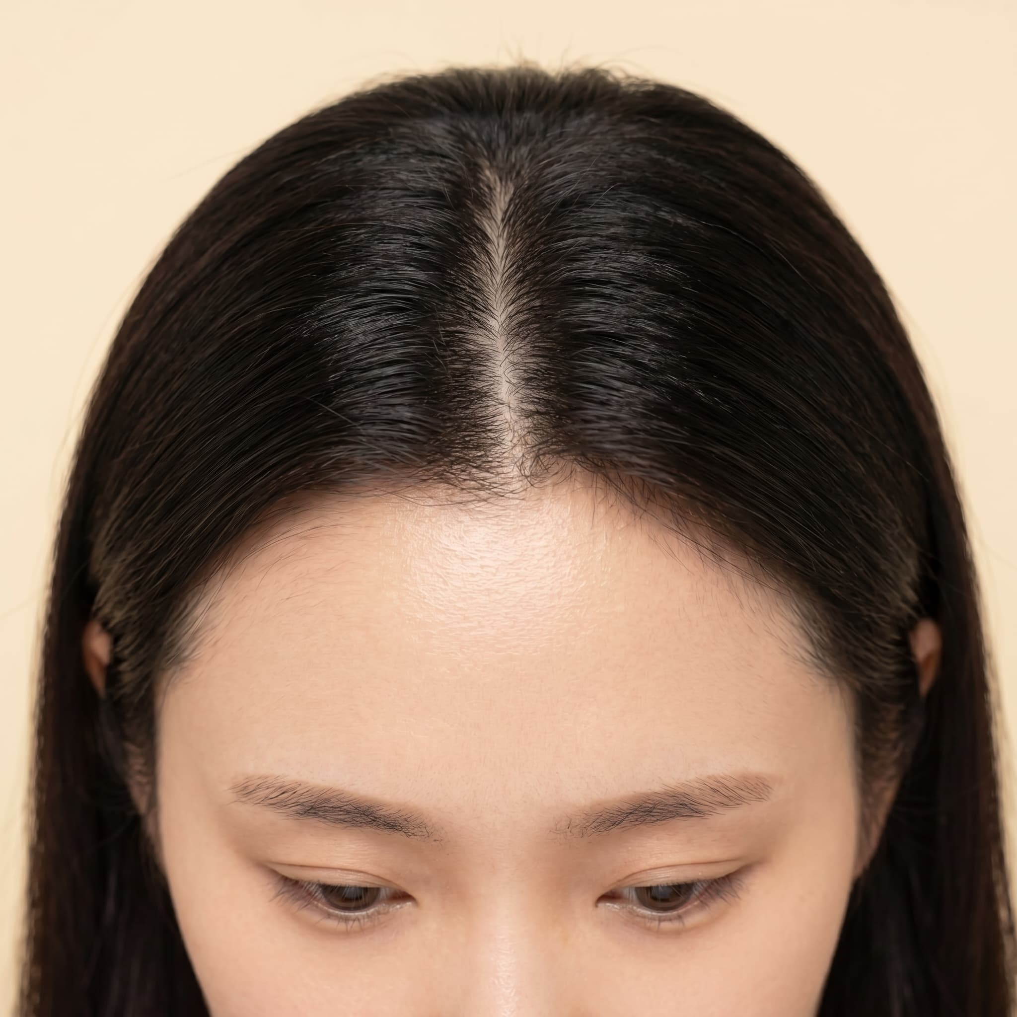 头皮状况恢复
