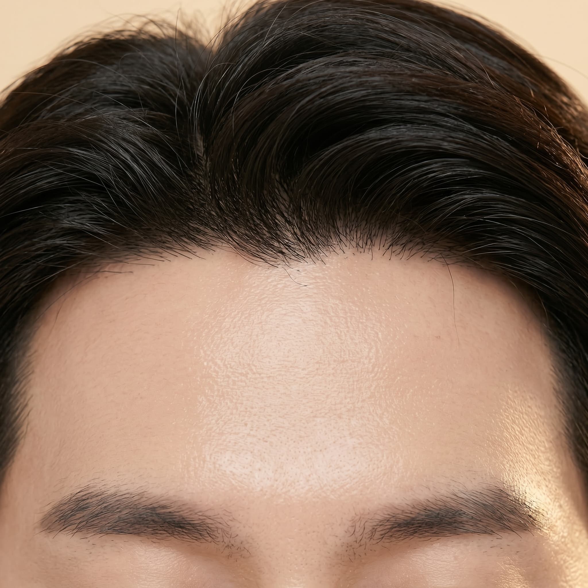 Hair Transplantation