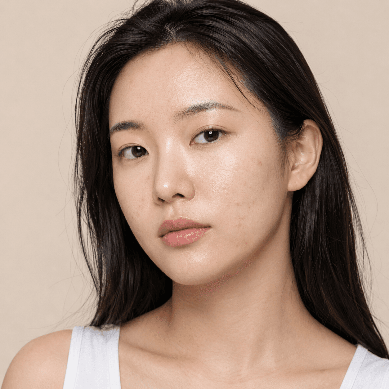 Recurring Acne, Scars, Pores