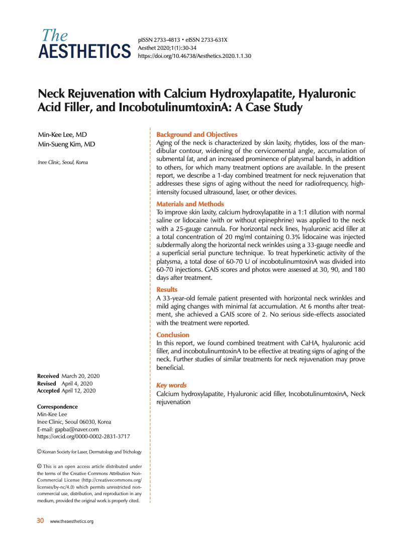Neck Rejuvenation with Calcium Hydroxylapatite, Hyaluronic Acid Filler, and IncobotulinumtoxinA: A Case Study
